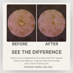 Dr.Melaxin Peel Shot