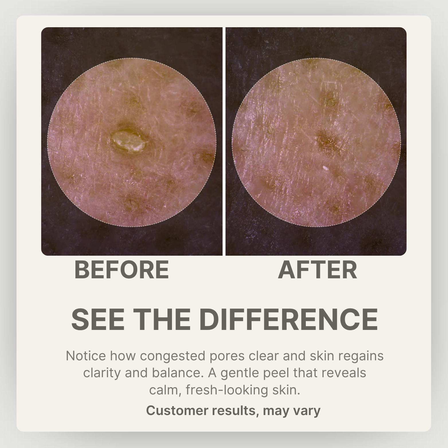 Dr.Melaxin Peel Shot