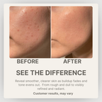 Dr.Melaxin Peel Shot