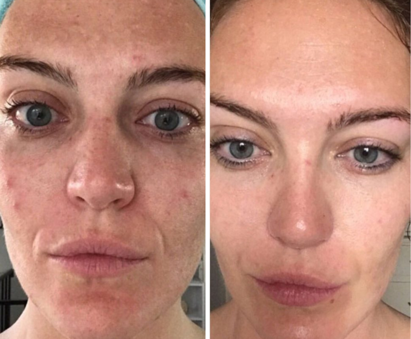 Customer testimonial